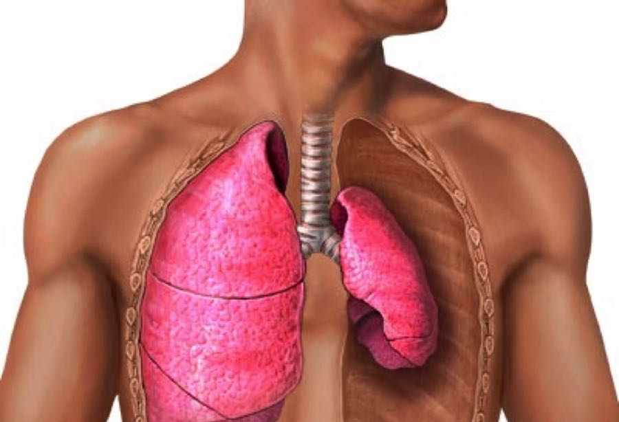 Barotrauma por squeeze pulmonar.