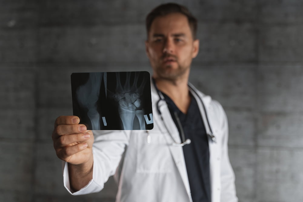 Médico del deporte revisando una radiografía.